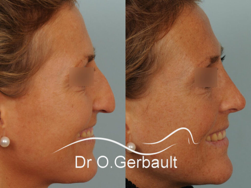 chirurgien révolutionnaire